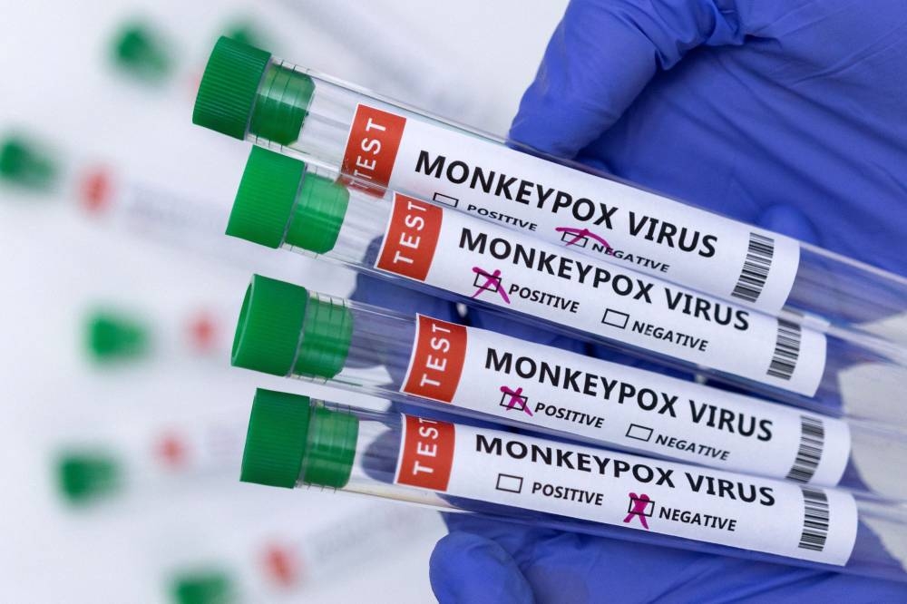 Quebec confirms 15 monkeypox cases, more expected elsewhere in Canada