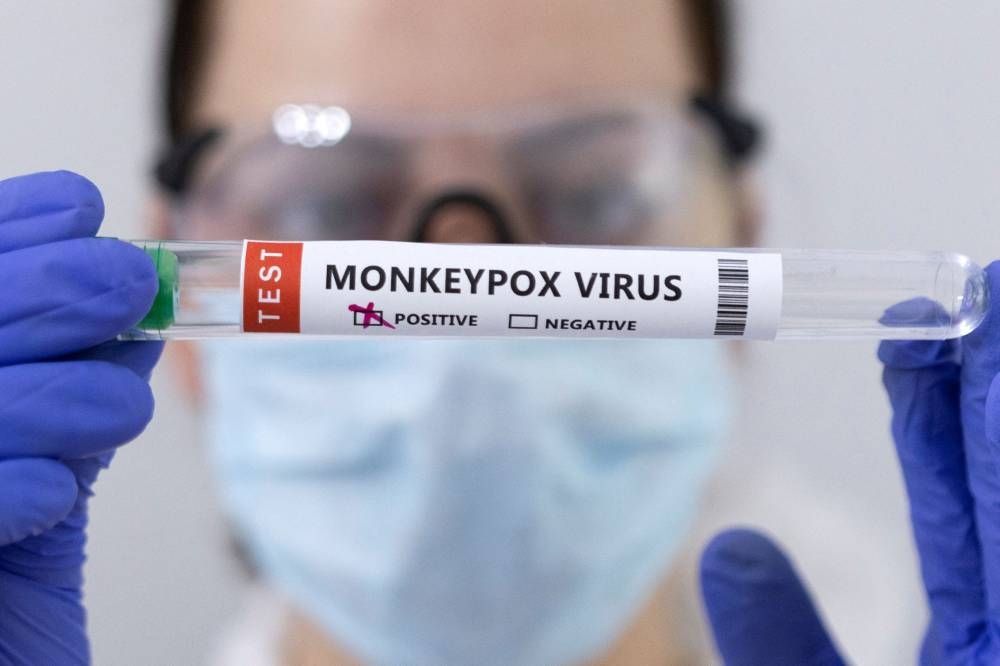 Spain reports 59 monkeypox cases