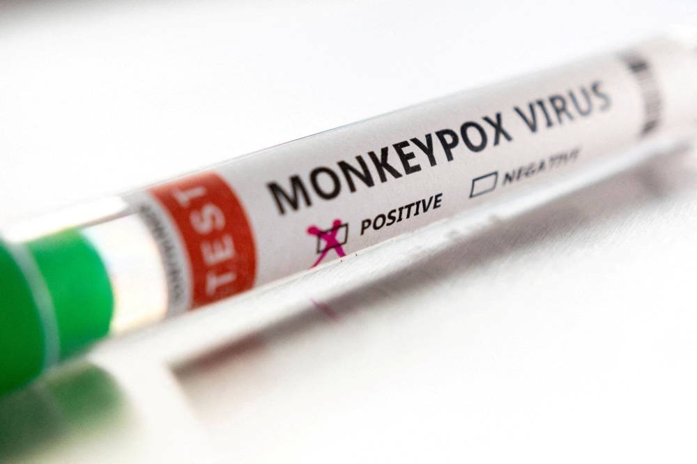 Health agency confirms community spread of monkeypox in England