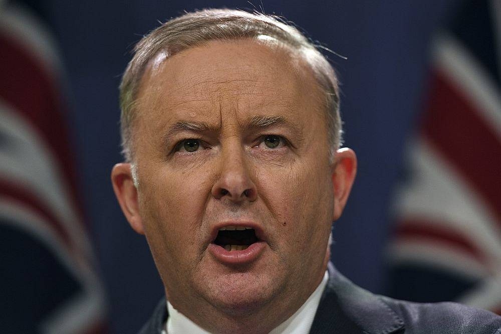 Prime Minister Anthony Albanese responded curtly when asked about a spat between Canberra and Beijing over the May 26 incident, which Australia’s government has described as 'very dangerous'. — AFP pic