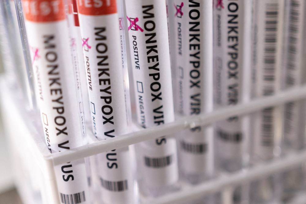 Test tubes labelled 'Monkeypox virus positive' are seen in this illustration taken May 22, 2022. — Reuters pic