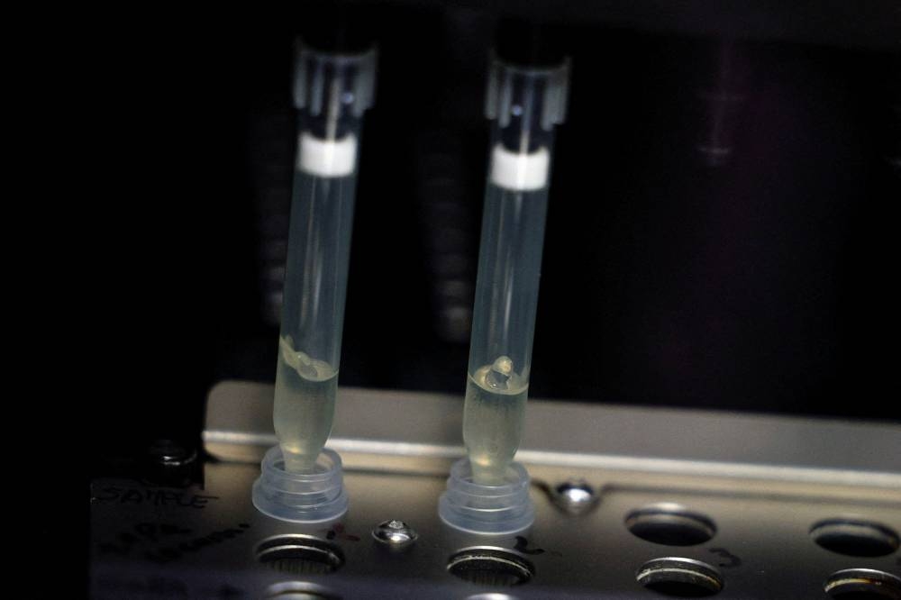 Two samples of suspected cases of monkeypox go through a process of nucleic acid extraction as they get tested at a microbiology lab at La Paz Hospital in Madrid, Spain, June 1, 2022. — Reuters pic