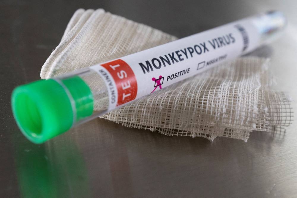 EU begins review of Bavarian Nordic's vaccine for monkeypox