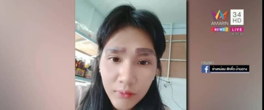 Thai woman Nipapron Meeking was left with two pairs of eyebrows following a botched procedure. — Screen capture from YouTube/ สาวสุดช้ำเพราะช่าง ไปสักคิ้วแต่ได้ติ้ว 2 ชั้นแบบนี้