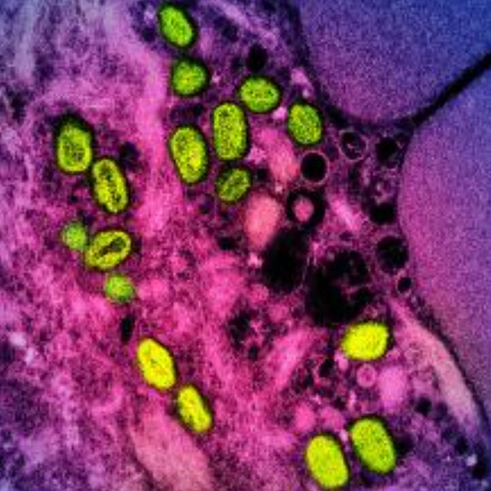 This undated file image obtained from the National Institute of Allergy and Infectious Diseases (NIAID) in Bethesda, Maryland, shows a colorized transmission electron micrograph of monkeypox particles (green) found within an infected cell (pink and purple), cultured in the laboratory. —  National Institute of Allergy and Infectious Diseases handout pic via AFP 