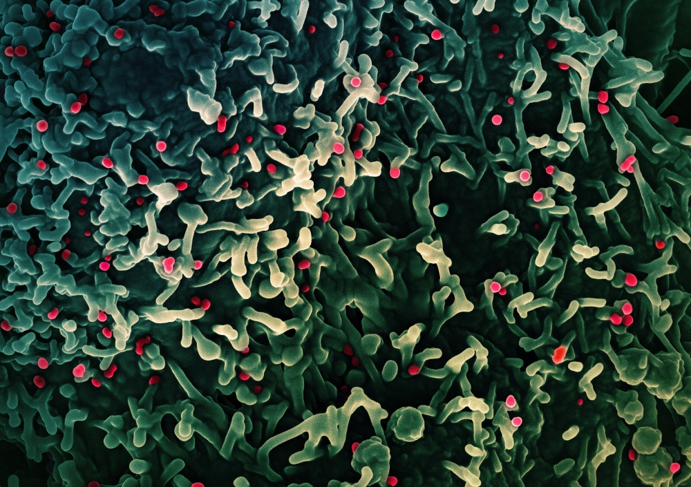 An undated colourised scanning electron micrograph of mpox virus (red) on the surface of infected VERO E6 cells (green), captured at the National Institute of Allergy and Infectious Diseases (NIAID) Integrated Research Facility (IRF) in Fort Detrick, Maryland. 