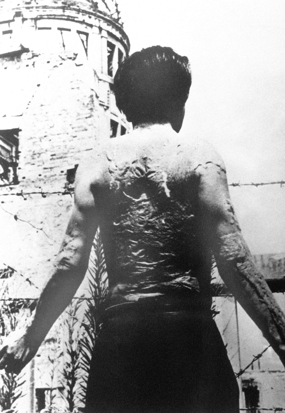 A file photo released on August 23, 1951 shows Kiyoshi Yoshikawa, a man whose back was totally burnt during the atomic bombing by the US army on Hiroshima, Japan, on August 6, 1945, as he leaves the hospital where he spent six years for treatment. — AFP pic