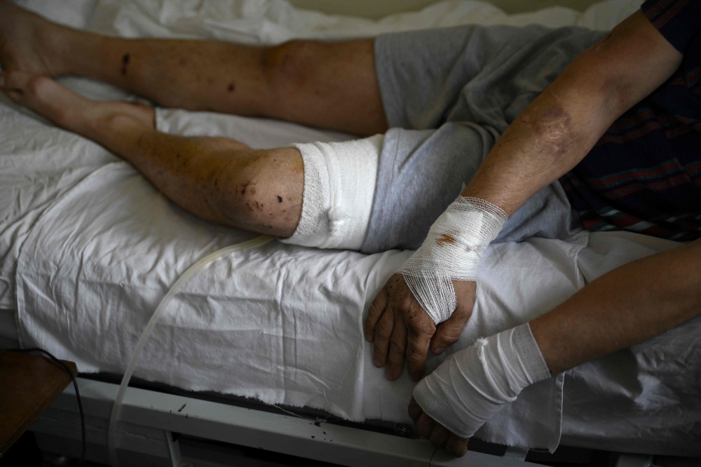 Wounded Ukrainian soldier Anton Sushko lies on his bed at the Mechnikov Hospital in Dnipro on September 26, 2024, amid the Russian invasion of Ukraine. — AFP pic