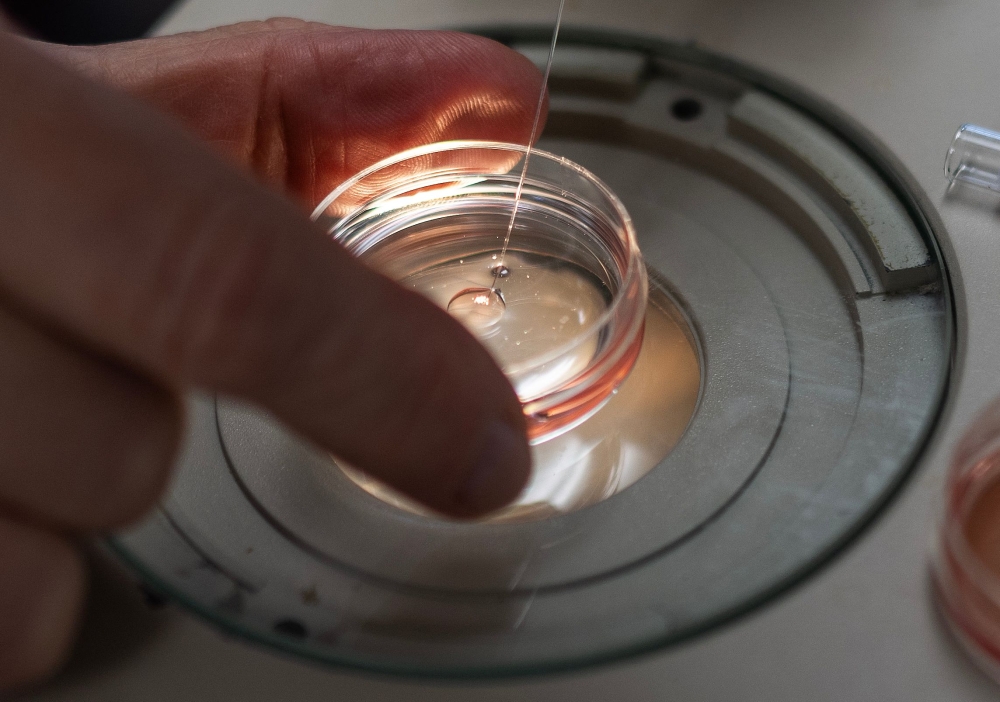 Oocytes are seen as they are prepared for an injection of genetic modifications at the Revivicor Laboratories in Blacksburg, Virginia on November 22, 2024. — AFP pic 