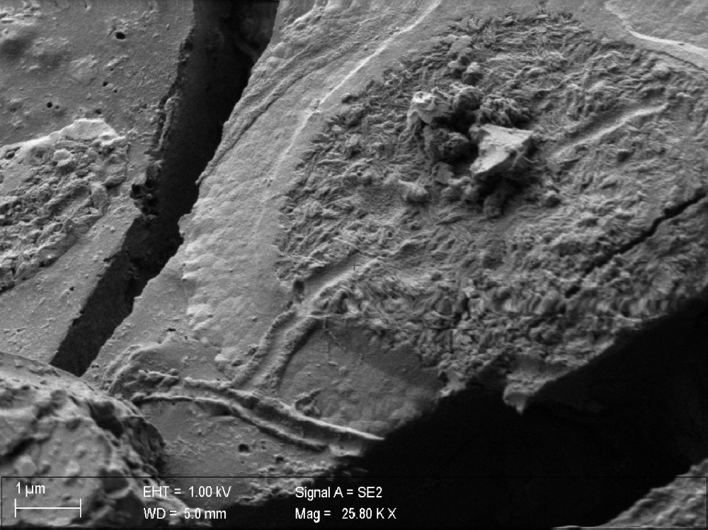 This handout image released on October 7, 2020, by the Roma Tre University, shows a scanning electron microscope (SEM) image of brain cells of a young man who died almost 2,000 years ago in the eruption of Mount Vesuvius, which caused the vitrification of his brain due to intense heat followed by rapid cooling. — Roma Tre University handout pic via AFP 